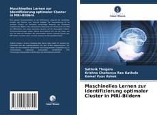 Bookcover of Maschinelles Lernen zur Identifizierung optimaler Cluster in MRI-Bildern