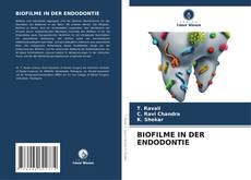 Buchcover von BIOFILME IN DER ENDODONTIE