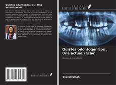 Обложка Quistes odontogénicos : Una actualización