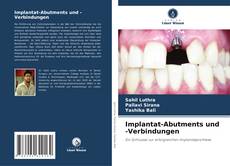Buchcover von Implantat-Abutments und -Verbindungen