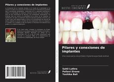 Capa do livro de Pilares y conexiones de implantes 
