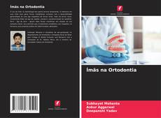 Bookcover of Ímãs na Ortodontia