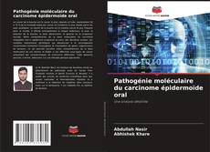 Buchcover von Pathogénie moléculaire du carcinome épidermoïde oral