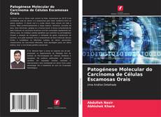 Buchcover von Patogénese Molecular do Carcinoma de Células Escamosas Orais