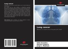 Copertina di Lung cancer