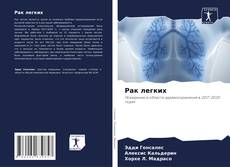 Buchcover von Рак легких