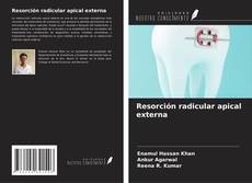 Обложка Resorción radicular apical externa