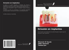 Oclusión en implantes kitap kapağı