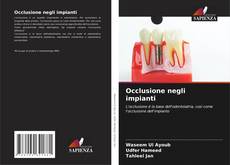 Bookcover of Occlusione negli impianti