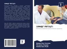 Couverture de 18ФДГ ПЕТ/ЦТ: