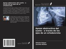 Bookcover of Apnea obstructiva del sueño - a través de los ojos de un ortodoncista