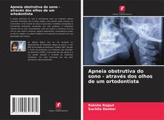 Bookcover of Apneia obstrutiva do sono - através dos olhos de um ortodontista