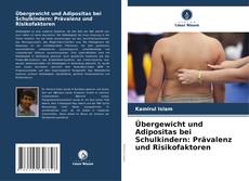Bookcover of Übergewicht und Adipositas bei Schulkindern: Prävalenz und Risikofaktoren