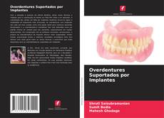 Buchcover von Overdentures Suportados por Implantes