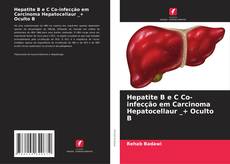 Couverture de Hepatite B e C Co-infecção em Carcinoma Hepatocellaur _+ Oculto B