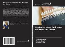 Capa do livro de Restauraciones indirectas del color del diente 