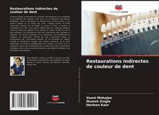Bookcover of Restaurations indirectes de couleur de dent