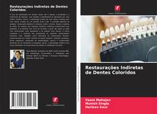 Couverture de Restaurações Indiretas de Dentes Coloridos