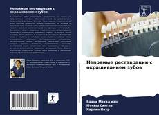 Buchcover von Непрямые реставрации с окрашиванием зубов
