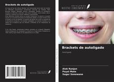 Bookcover of Brackets de autoligado