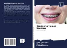 Обложка Самолигирующие брекеты