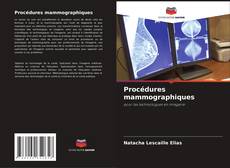 Capa do livro de Procédures mammographiques 
