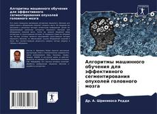 Bookcover of Алгоритмы машинного обучения для эффективного сегментирования опухолей головного мозга