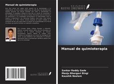 Обложка Manual de quimioterapia