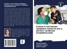 Buchcover von Слюна и состояние здоровья полости рта у детей с особыми потребностями