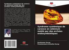 Buchcover von Syndrome systémique de carence en sélénium médié par des archées endosymbiotiques