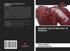 Couverture de Hydatid cyst of the liver in children