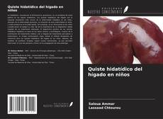 Bookcover of Quiste hidatídico del hígado en niños