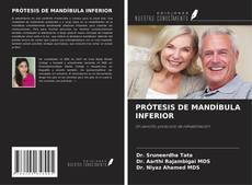 Couverture de PRÓTESIS DE MANDÍBULA INFERIOR