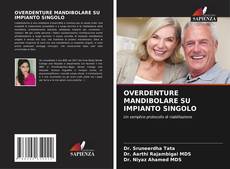 Bookcover of OVERDENTURE MANDIBOLARE SU IMPIANTO SINGOLO