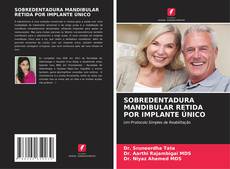 Capa do livro de SOBREDENTADURA MANDIBULAR RETIDA POR IMPLANTE ÚNICO 