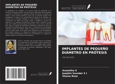 Bookcover of IMPLANTES DE PEQUEÑO DIÁMETRO EN PRÓTESIS