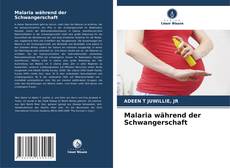 Bookcover of Malaria während der Schwangerschaft