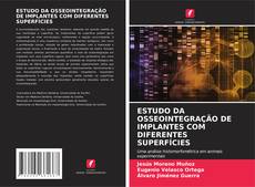 Обложка ESTUDO DA OSSEOINTEGRAÇÃO DE IMPLANTES COM DIFERENTES SUPERFÍCIES