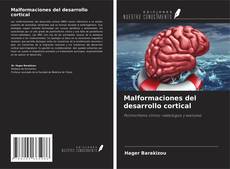 Bookcover of Malformaciones del desarrollo cortical
