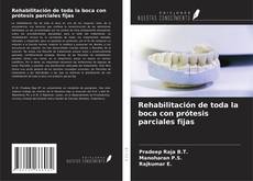 Buchcover von Rehabilitación de toda la boca con prótesis parciales fijas