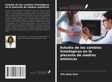 Bookcover of Estudio de los cambios histológicos en la placenta de madres anémicas