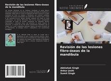 Bookcover of Revisión de las lesiones fibro-óseas de la mandíbula