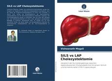 Bookcover of SILS vs LAP Cholezystektomie