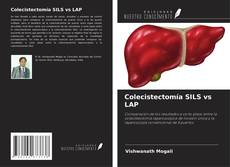 Capa do livro de Colecistectomía SILS vs LAP 