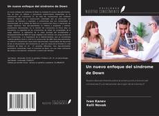 Bookcover of Un nuevo enfoque del síndrome de Down