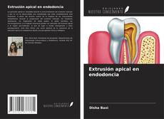 Bookcover of Extrusión apical en endodoncia