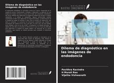 Buchcover von Dilema de diagnóstico en las imágenes de endodoncia