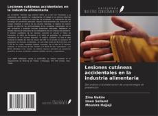Buchcover von Lesiones cutáneas accidentales en la industria alimentaria