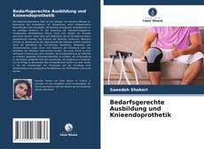 Bookcover of Bedarfsgerechte Ausbildung und Knieendoprothetik