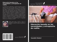 Buchcover von Educación basada en las necesidades y artroplastia de rodilla